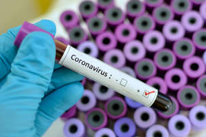 Число умерших от коронавируса перевалило за тысячу человек